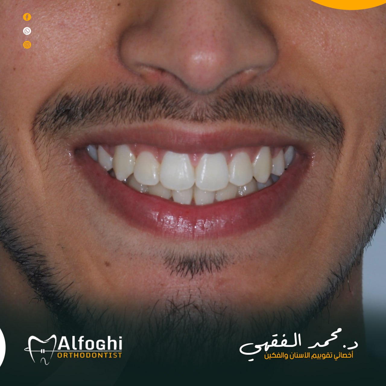 patient Ahmed